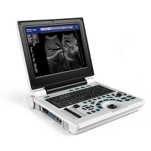 HM30 Black And White Ultrasound 