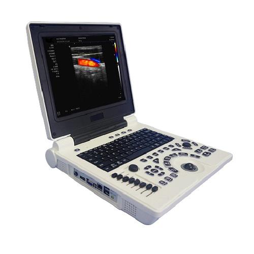 HM300 Notebook Color Doppler 