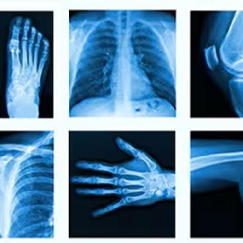 The Main Difference Between X-ray And Digital Radiography (DR) 