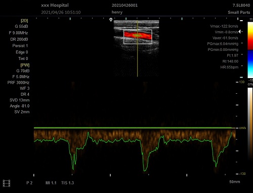 Hawmed Ultrasound.jpg