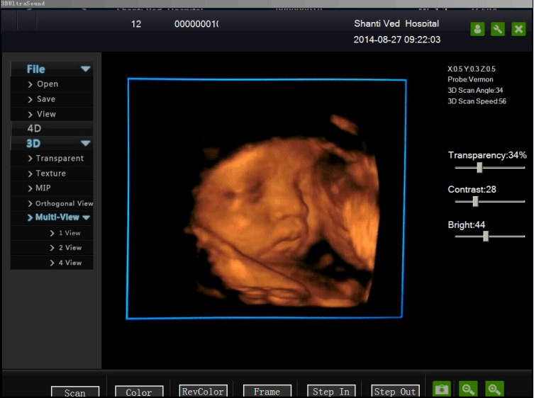 Hawmed Ultrasound.png