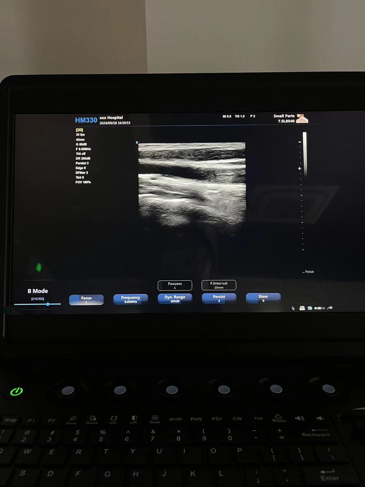 Hawmed HM330 Color Doppler.jpg