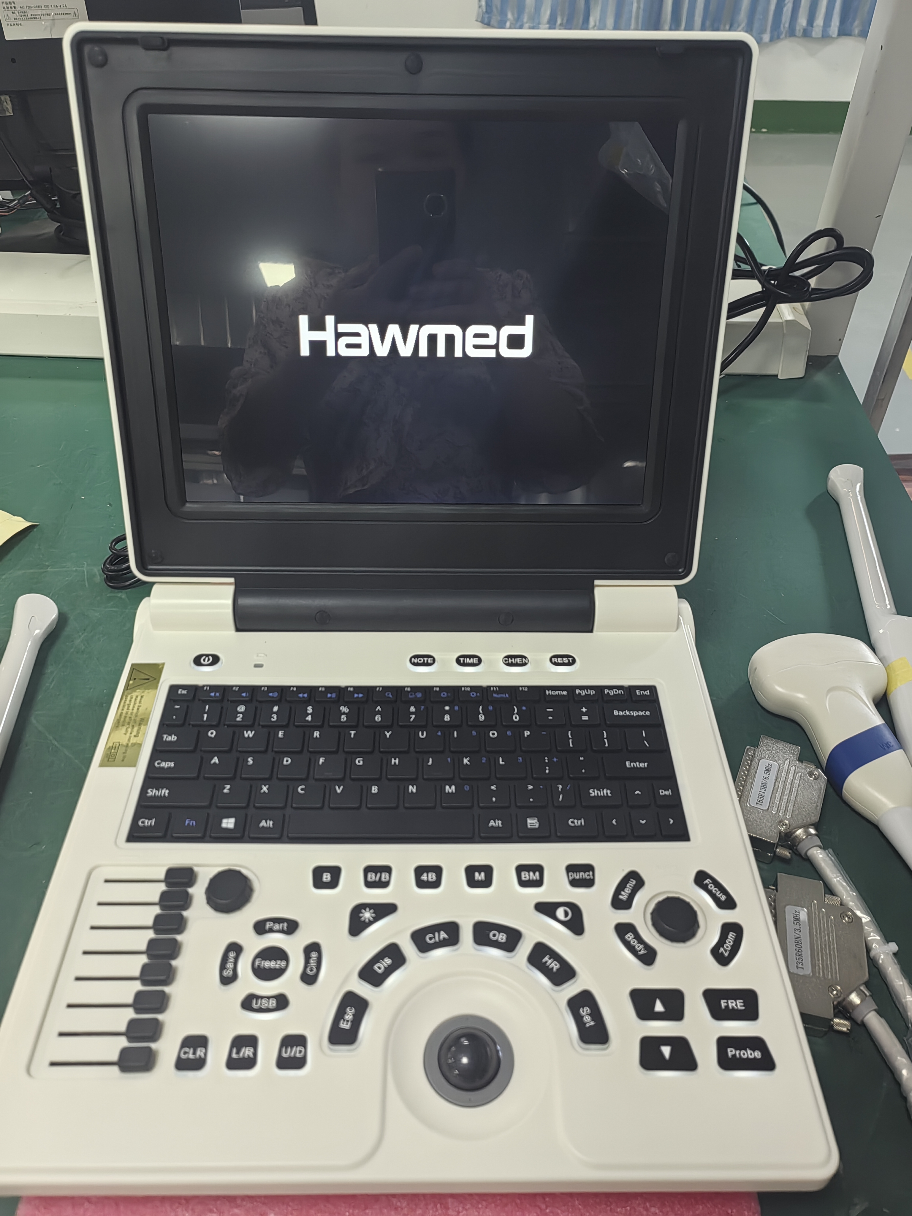 Hawmed Black And White Ultrasound.jpg