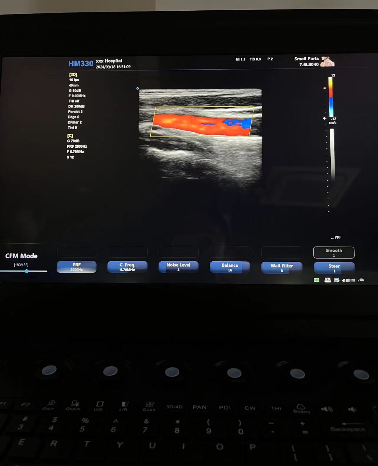 Hawmed Portable Color Ultrasound.jpg