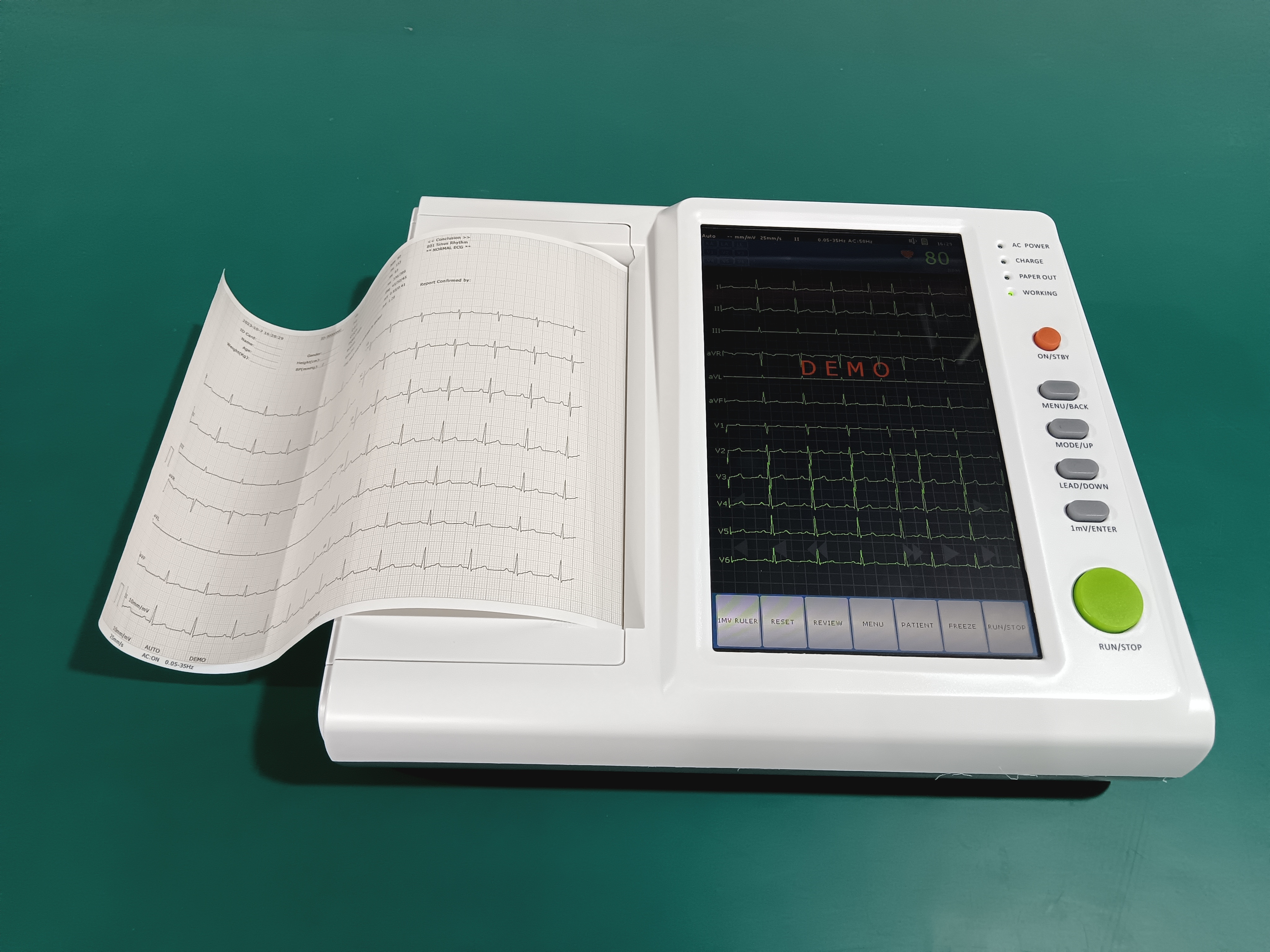 Hawmed ECG.jpg