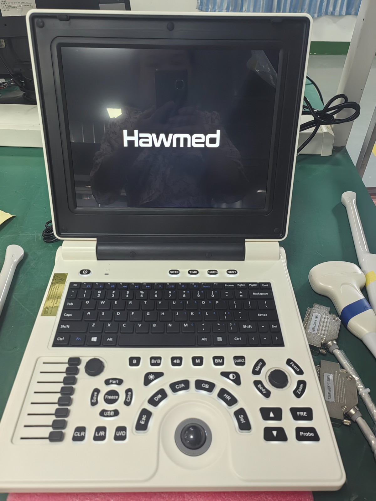 Hawmed Black And White Ultrasound.jpg